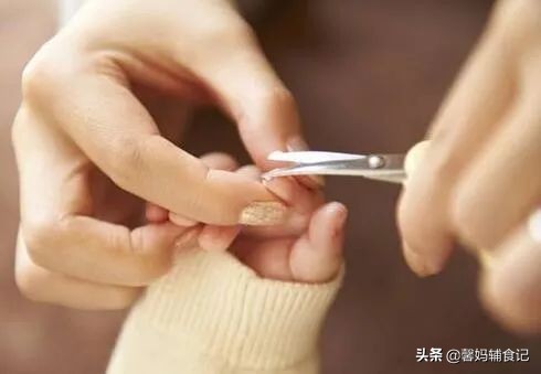 宝宝手上有倒刺应该怎么解决,宝宝手上长倒刺用什么药