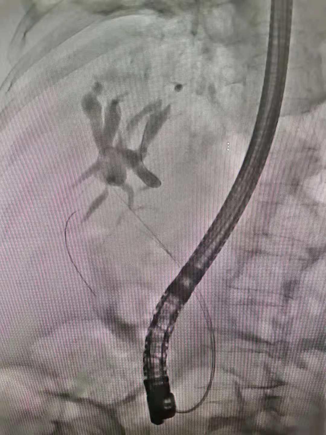 南大二附院红角洲分院具体位置,南大二附院红角洲分院优势