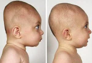 头骨有哪些有意思的特点,你的后脑勺是圆还是扁