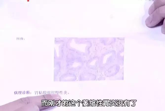 行医59年81岁老中医,一女子胃癌喝中药治好了
