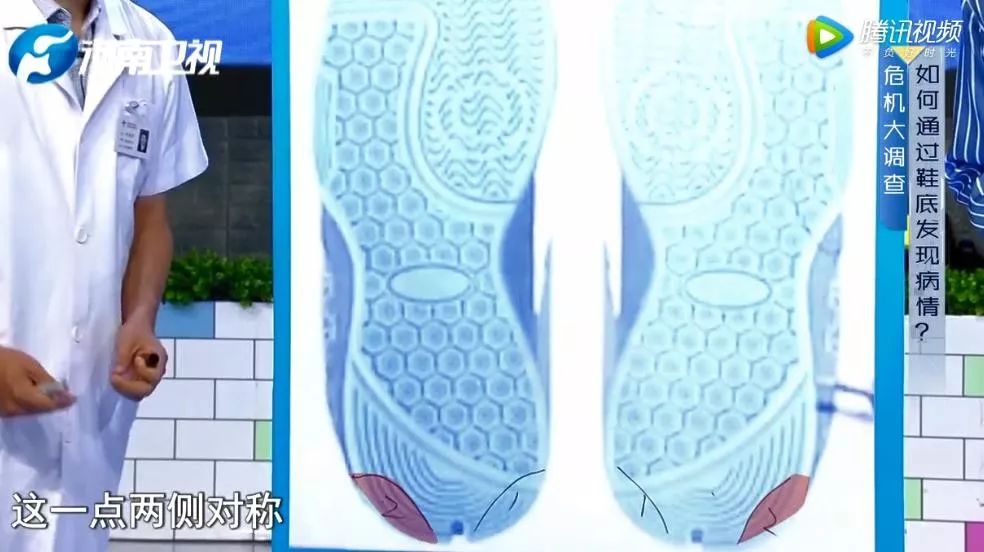 养生益阳：身体好不好，看你的鞋子就知道
