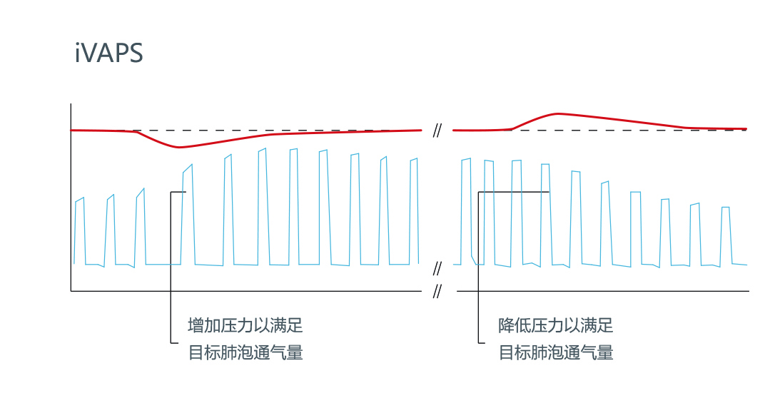 呼吸机st和s9有什么区别,s9vpap