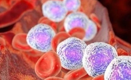 淋巴瘤是一种很难治的病吗,淋巴瘤典型的临床表现及诊断方法