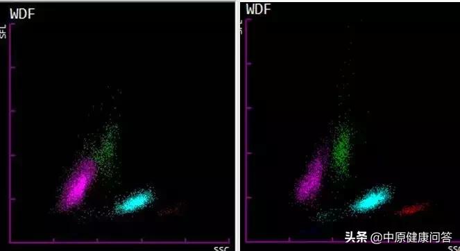 小小血常规,隐藏大奥秘