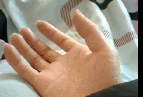 手冷手心出汗怎么解决,手凉手心出汗什么原因怎么解决