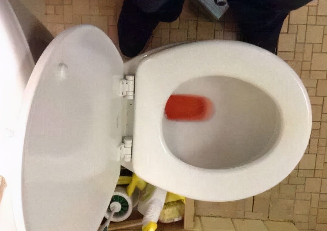 小便刺痛并带血是什么原因,妇科小便带血是什么原因