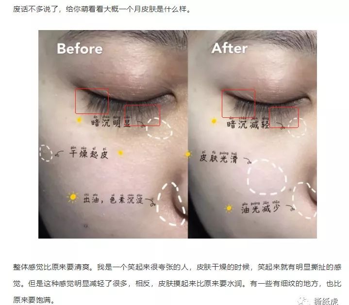 swisse益生菌软糖避雷,swisse水光瓶测评避雷