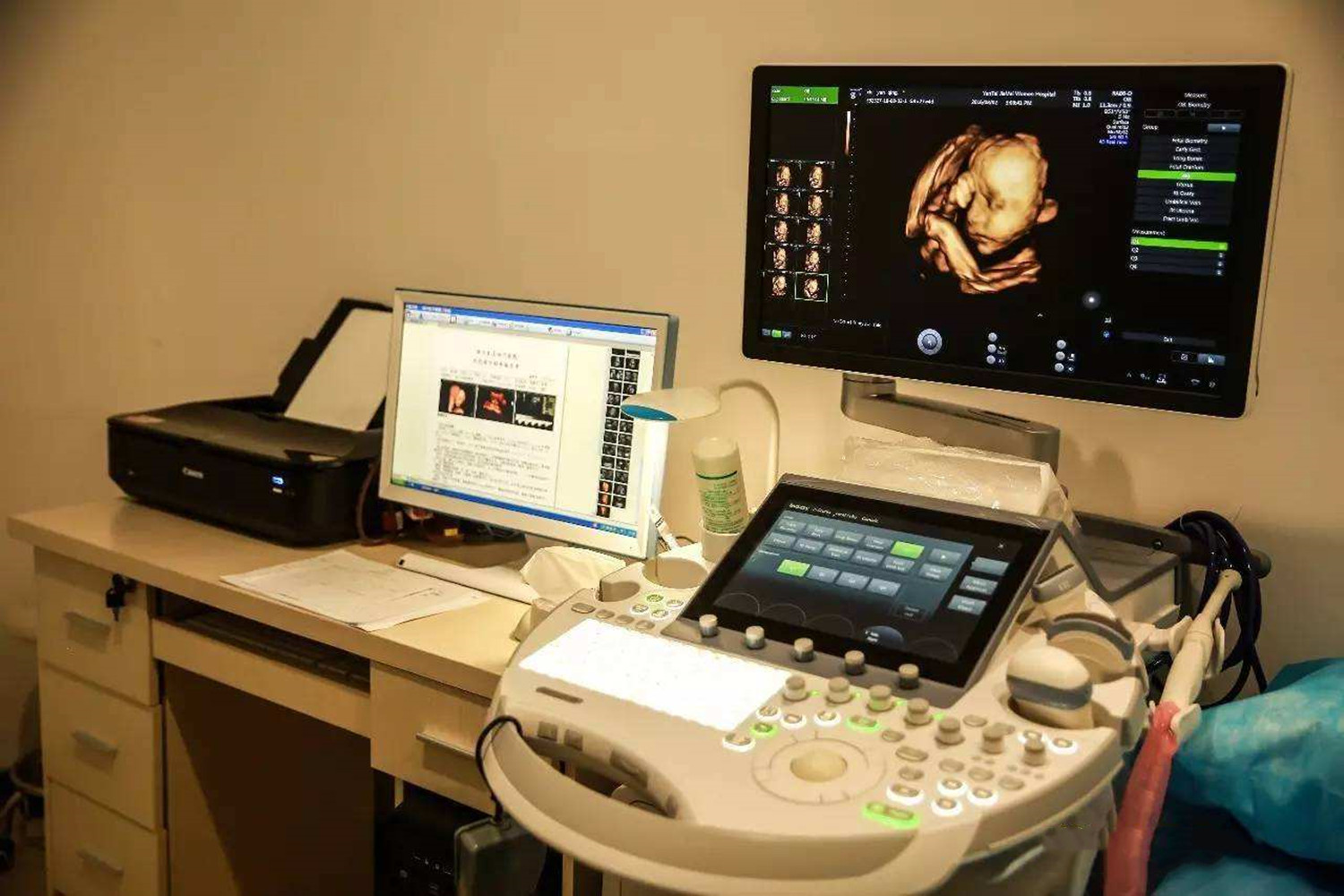 孕期看宝宝照片管用吗,孕期四维彩超看五官