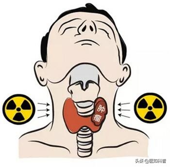 甲亢患者应警惕的6大误区,甲亢治疗的5大原则