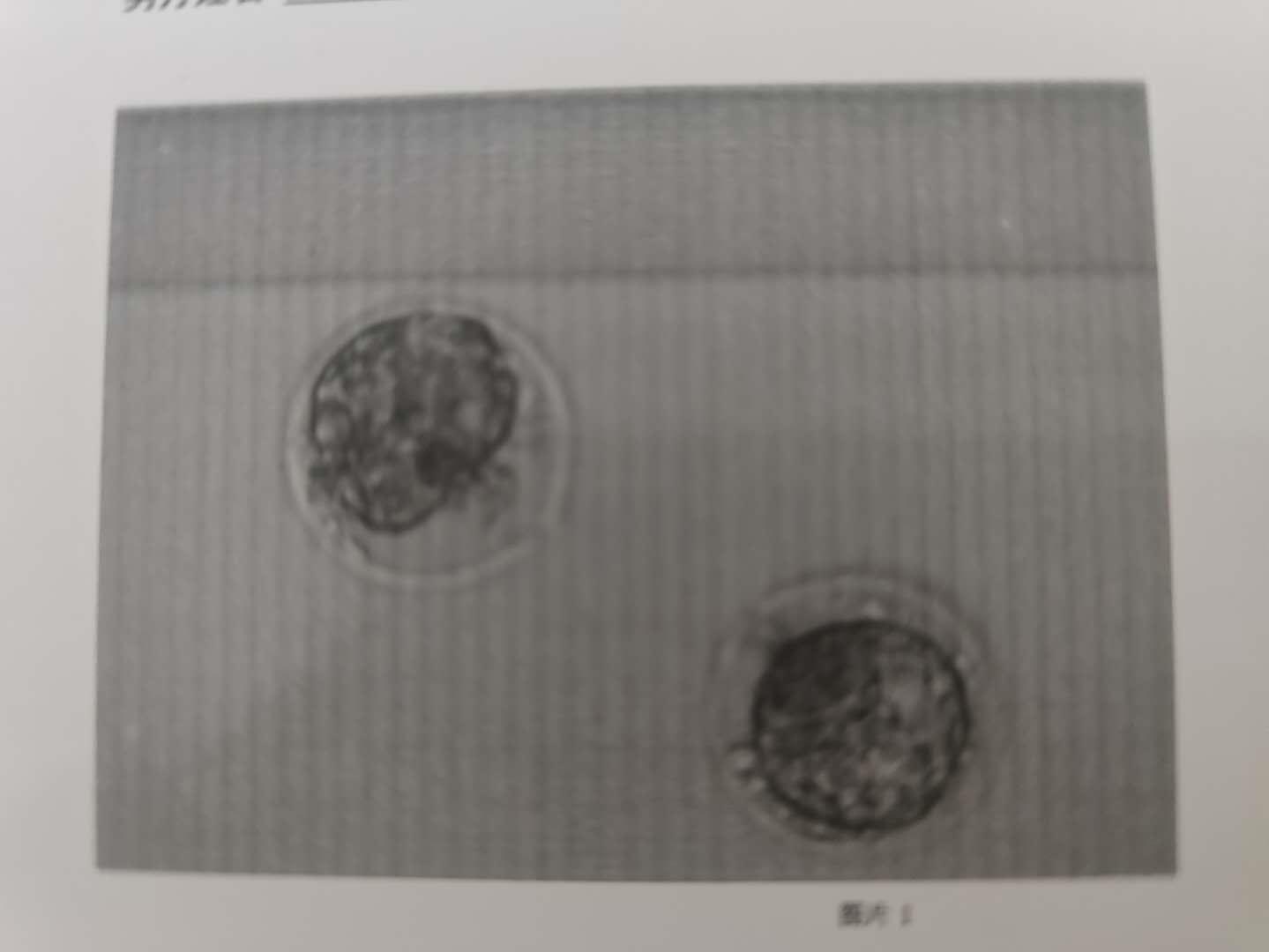 孕妇套话医生问男女,被识破臊一脸,这7项看男女的说法有效吗?