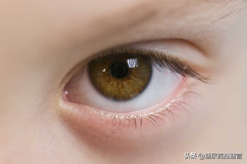 糖尿病控糖的十种蔬菜,糖尿病控糖杂粮有哪些