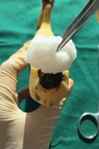 宝宝玩小JJ、包皮割不割?这9个小JJ的问题,有男宝的家长赶紧看