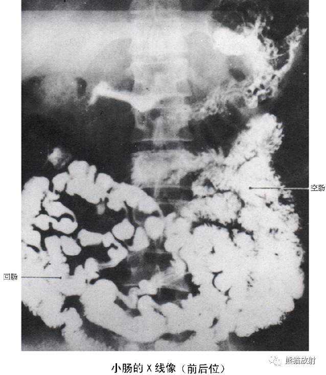 详细的消化道造影+彩色解剖图