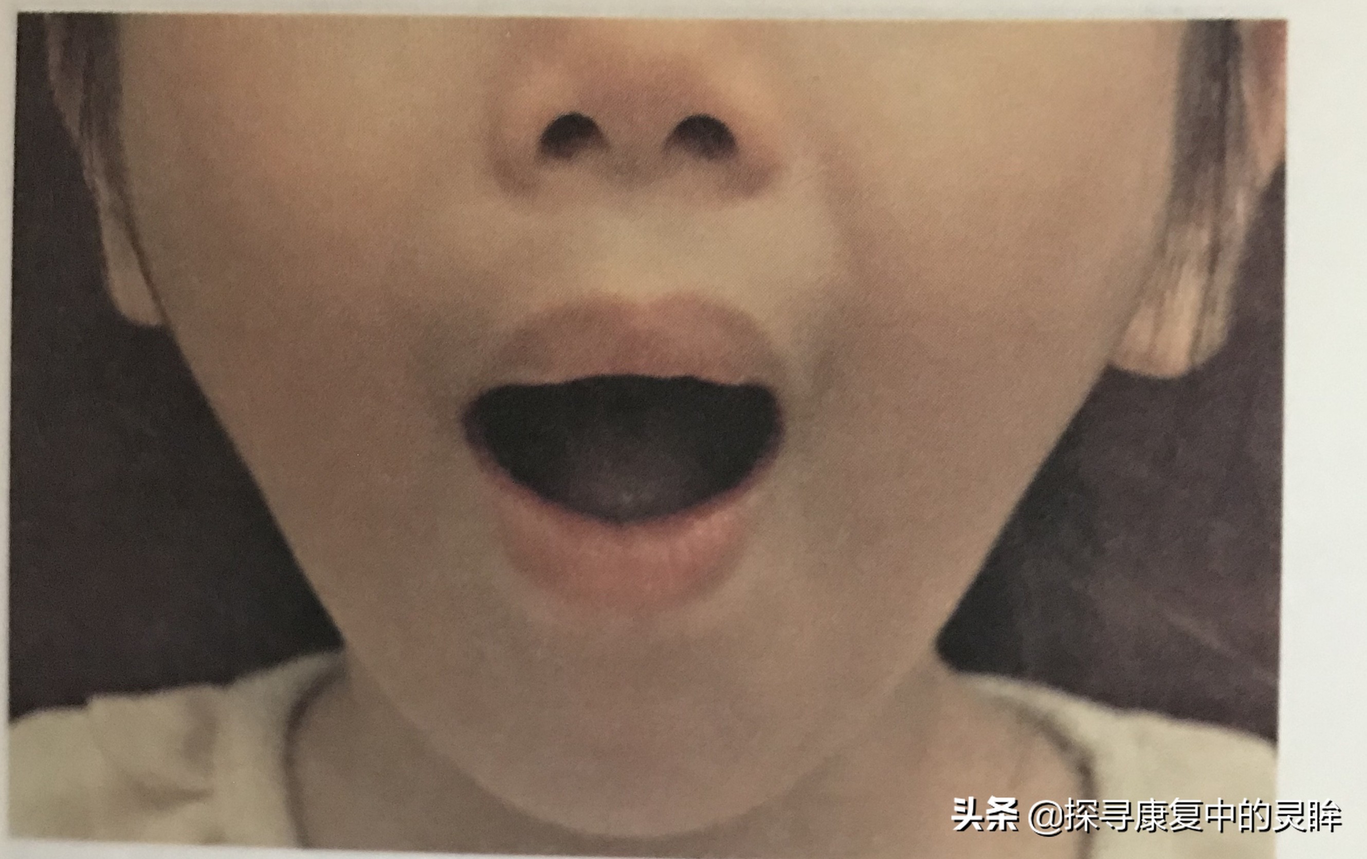 五种口部运动:灵活孩子的樱桃小嘴,让他们说话更清晰(超简单)