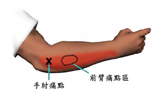 手腕、胳膊疼痛难忍,久治不愈如何破?关节骨科博士助你解烦忧
