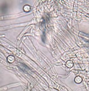 草莓苗期枯萎病如何治疗,草莓枯萎病的症状施什么肥