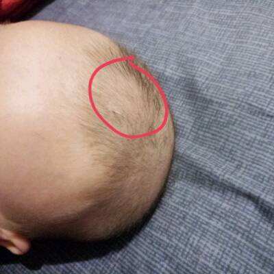 宝宝的哪些部位需要保暖,宝宝的哪些部位需要暖哪些需要凉