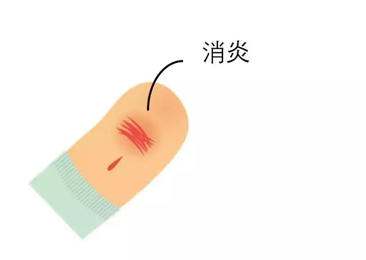 关于高锰酸钾的初中所有知识点,高锰酸钾的药用知识