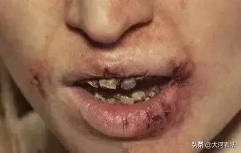 不堪入目！吸毒后的男女如此造孽！*毒冰**竟如此恐怖