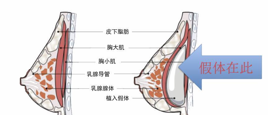 木瓜真能丰胸么,木瓜真的能丰胸吗效果怎么样