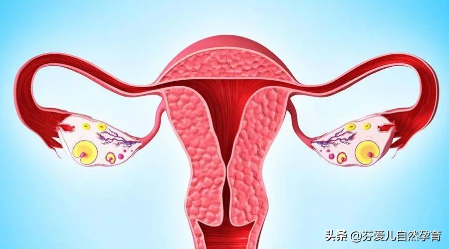 如何预防卵巢早衰,针灸治疗卵巢早衰