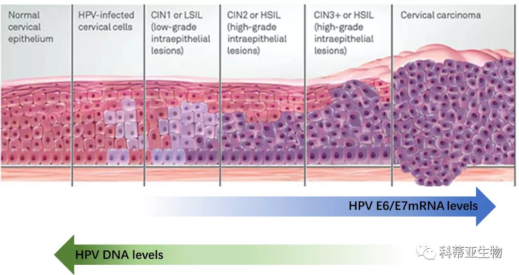 国际hpv视频,国际hpv最新信息