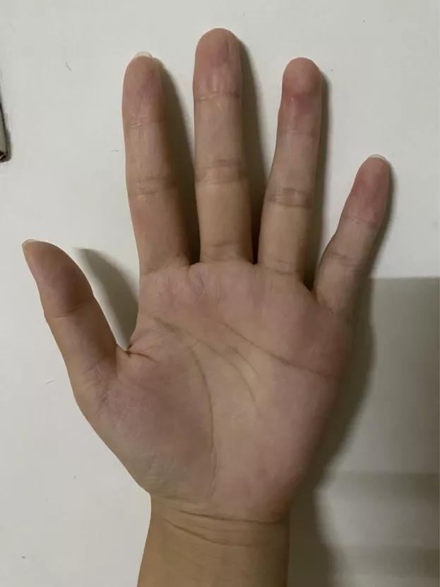 手诊看身体状况准吗,手诊手指看健康