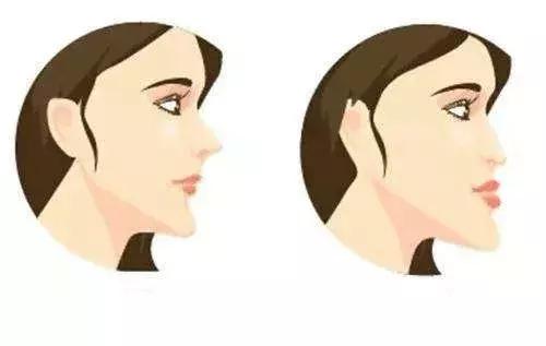 隆鼻运用什么材料,隆鼻作用好吗