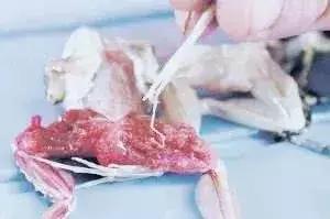 28岁小伙癫痫16年，脑子被虫吃了！竟是爸爸给他吃这个珍稀“大补”！