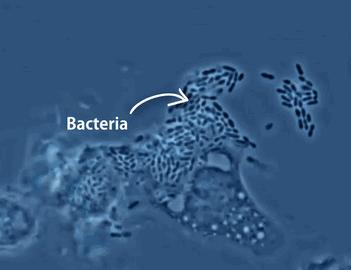 通过化疗能彻底杀死早期癌细胞吗,肿瘤免疫时代来临谁能从中获益