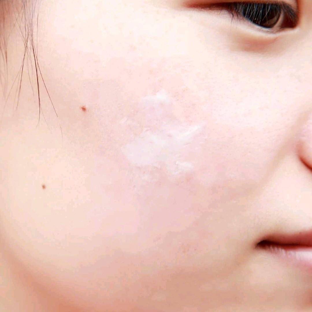 模特人像拍摄方法,模特拍摄前消肿