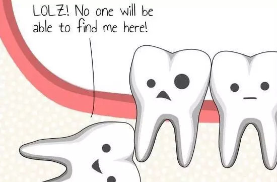 最简单的智齿拔除多少钱一颗,拔除智齿一般多少钱一颗