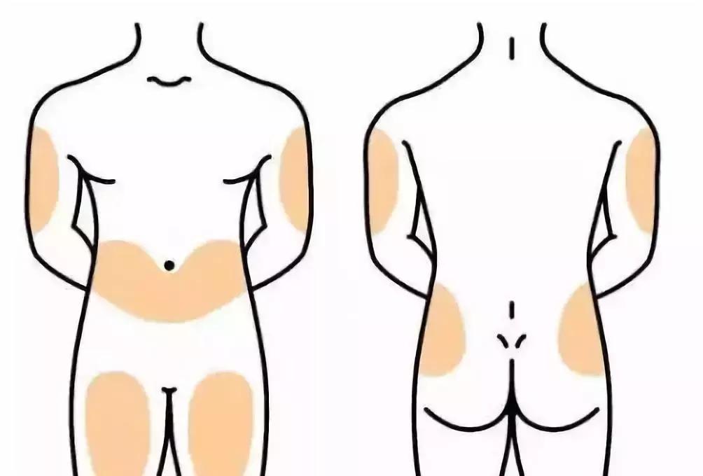 胰岛素注射部位红肿硬化怎么办,打胰岛素肚皮有硬结淤青怎么回事