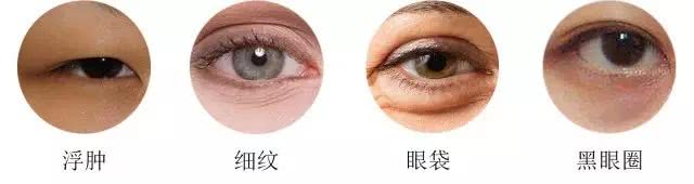 黑眼圈一直在怎么消下去,黑眼圈一直消不了怎么办