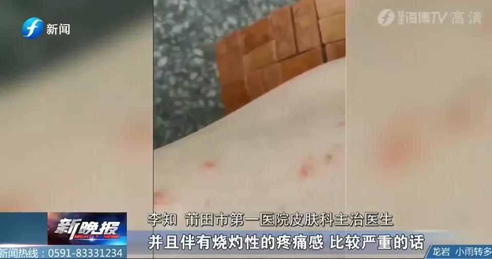 户外远离虫子的方法,哪些虫子在户外小朋友是不能碰的