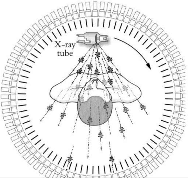 新冠肺炎白肺的形成,新冠肺炎白肺能恢复好吗