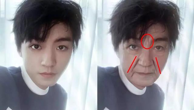 硬刚女皇龙妈也扛不住法令纹，2条沟壑让人心疼，贴一贴就消了