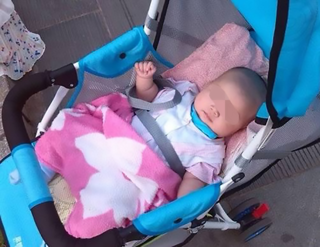 四个月婴儿脊柱变形怎么治疗,5个月宝宝脊柱发育错误