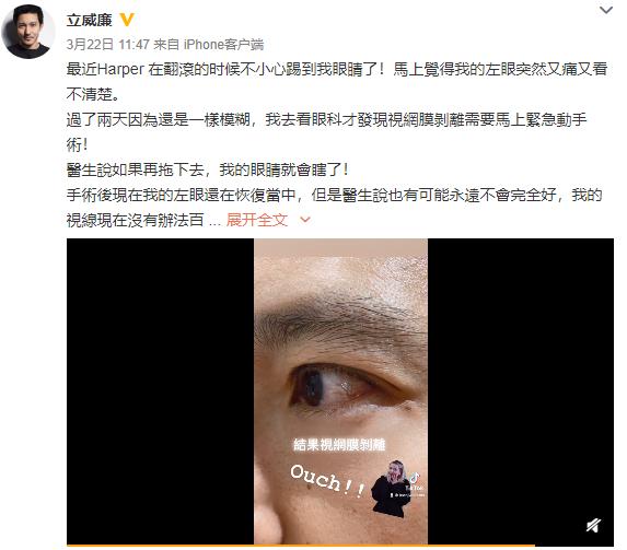 张萌被3岁女儿*力暴**戳伤鼻子,皮掀起来一块疼哭,在线求祛疤妙招