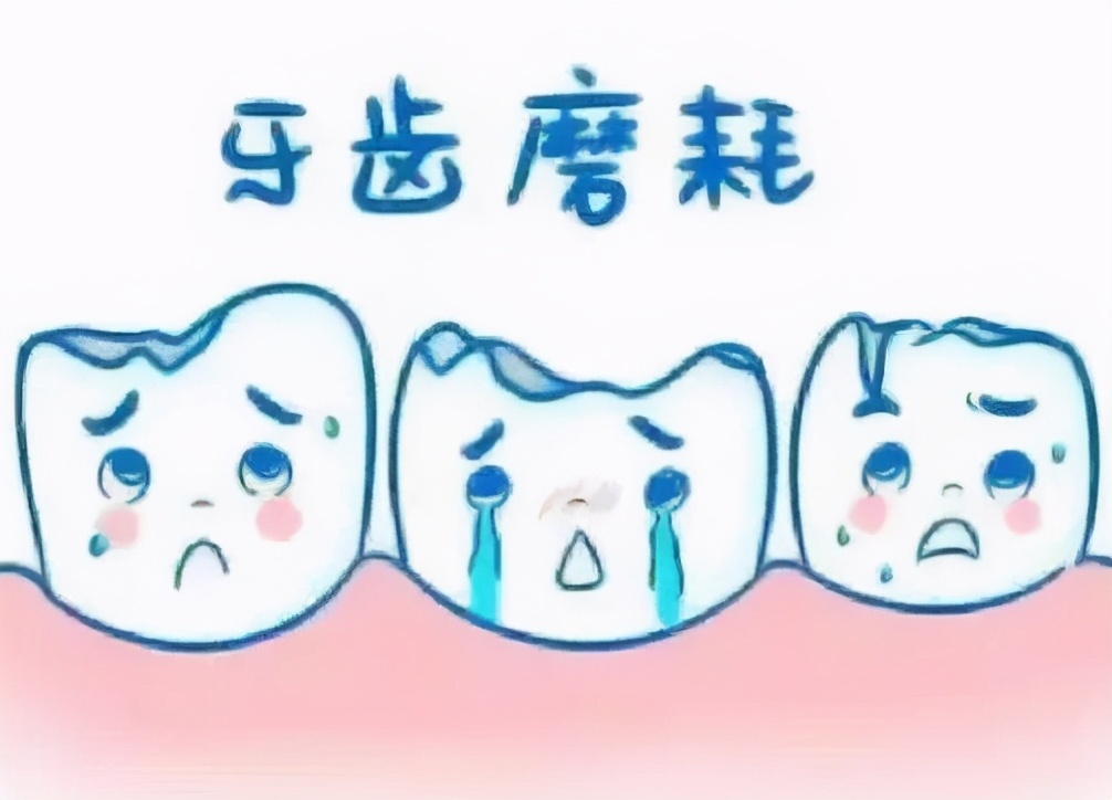 如何防止牙釉质磨损,如何预防牙齿脱钙