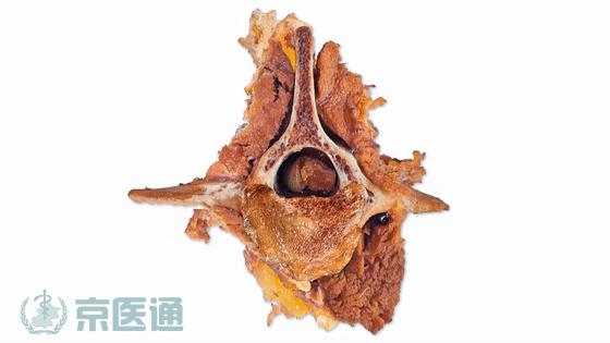 腰痛骨科怎么治疗,腰痛腿痛有什么特效药