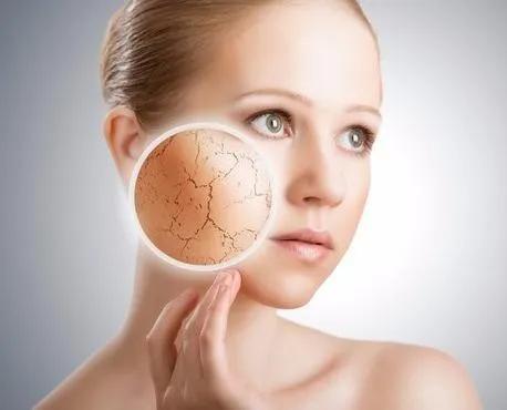 秋天皮肤瘙痒脱皮怎么办,秋季干燥皮肤发痒用什么药膏