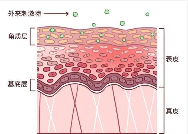 角质层被划破会感染狂犬吗,角质层破坏是皮肤屏障受损吗