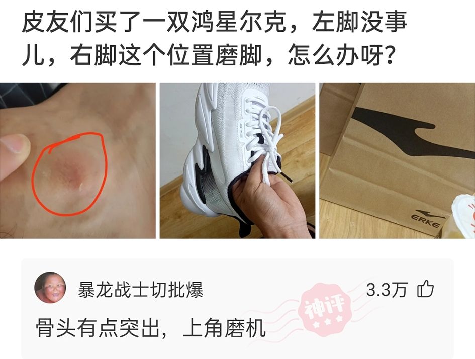 神评论：有人买了一双鸿星尔克，磨脚。网友：脚的问题，上角磨机