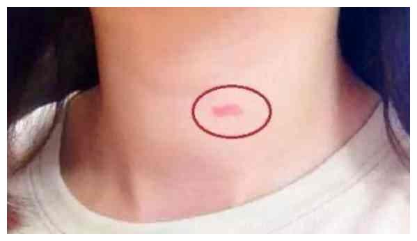 发现女儿脖子有“草莓印”，爸爸再三追问，孩子的话引人深思