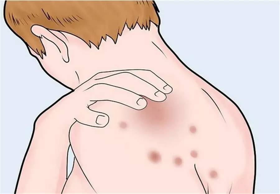 肿瘤来源于皮肤附属器是什么意思,皮肤附属器源性肿瘤能治好吗