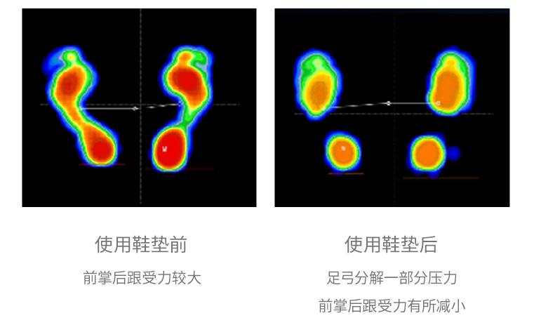 打篮球崴脚脱鞋捏脚,打篮球怎么避免崴脚