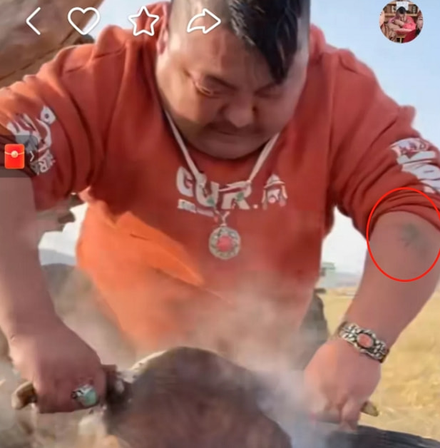 一顿饭吃一只羊？恩克30岁出头体重近400，手臂开始出现“黑斑”