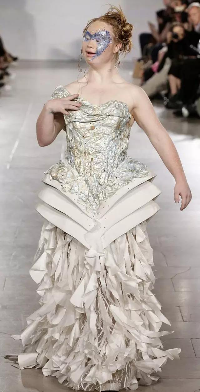 唐氏综合征中国美女,患有唐氏综合征的维密模特