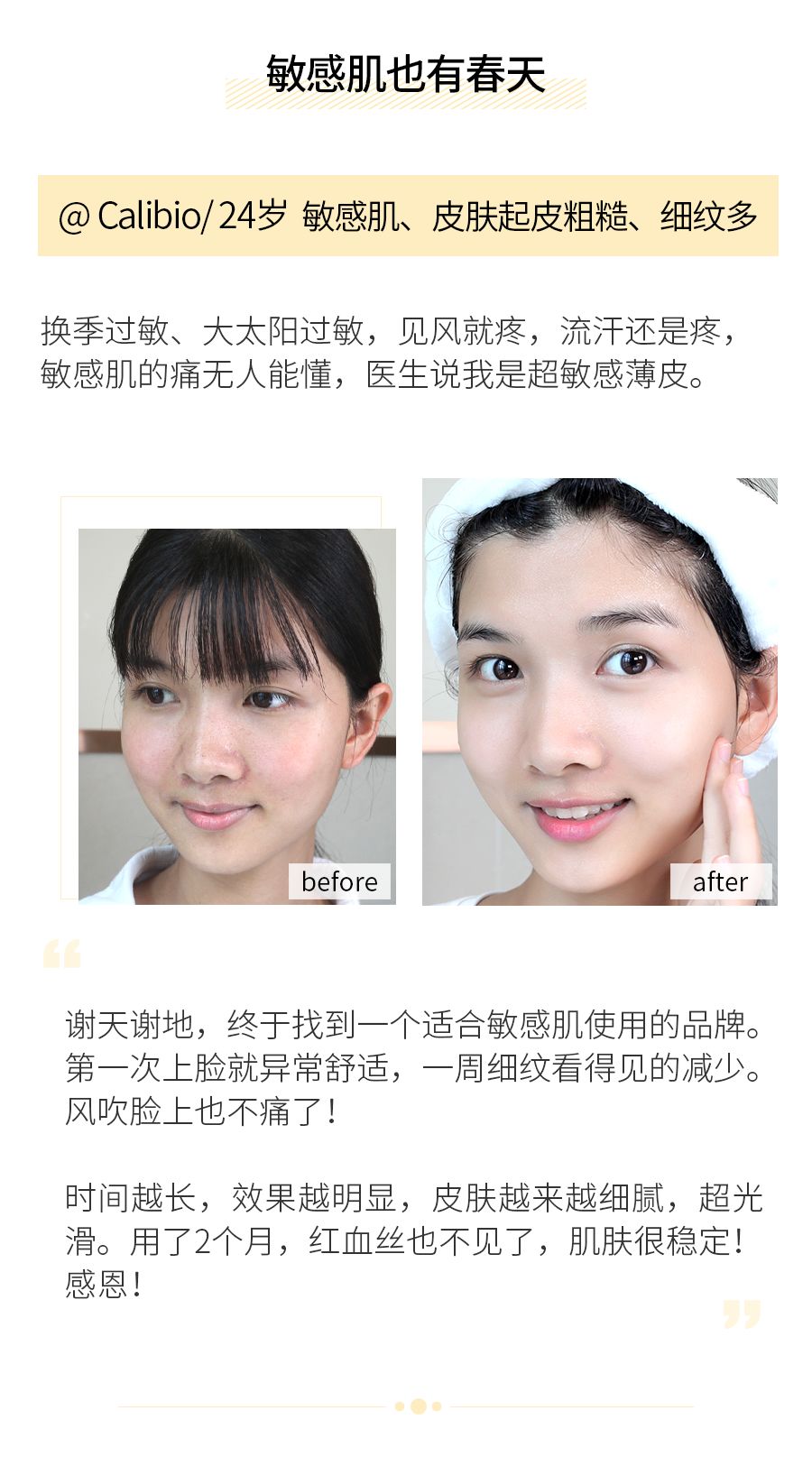 琚佸濮楁帹鑽愯憽钀勭苯鎶よ偆,琚佸濮楄憽钀勭苯绮惧崕